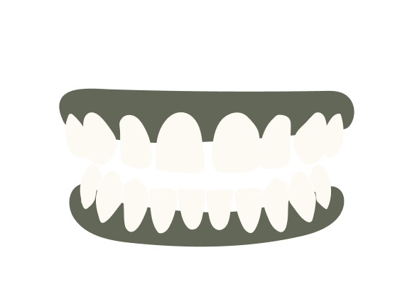 Gapped Teeth