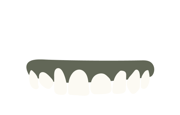 Irregular Length Teeth