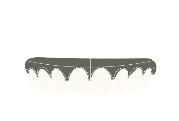 Misalignment Smile Line Due to Asymmetrical  Teeth Arrangement