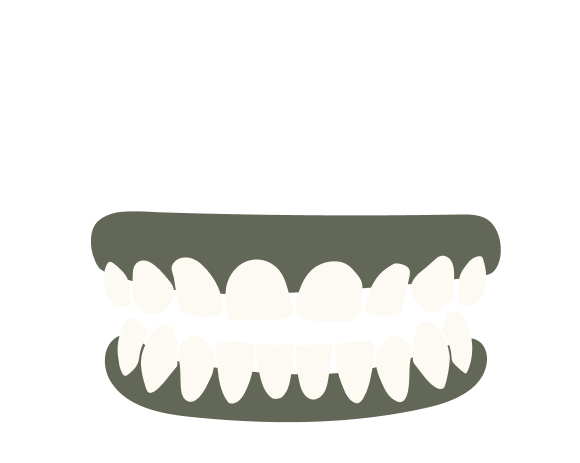 Over-revealing of Teeth Gum