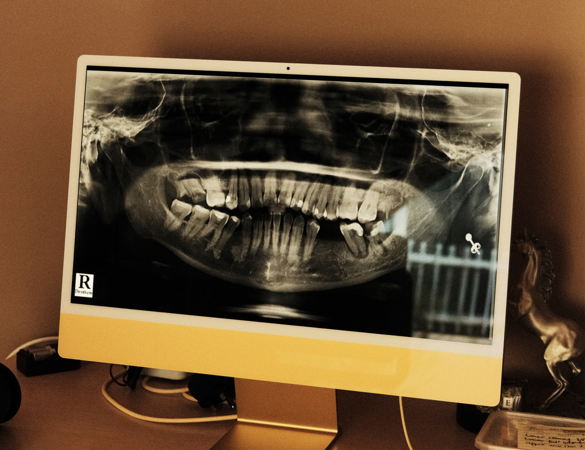 CT Scan and Individualized Surgery Treatment Plan