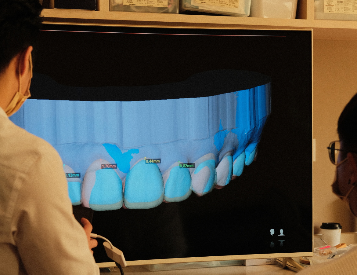 Diagnosis and Veneers Treatment Planning