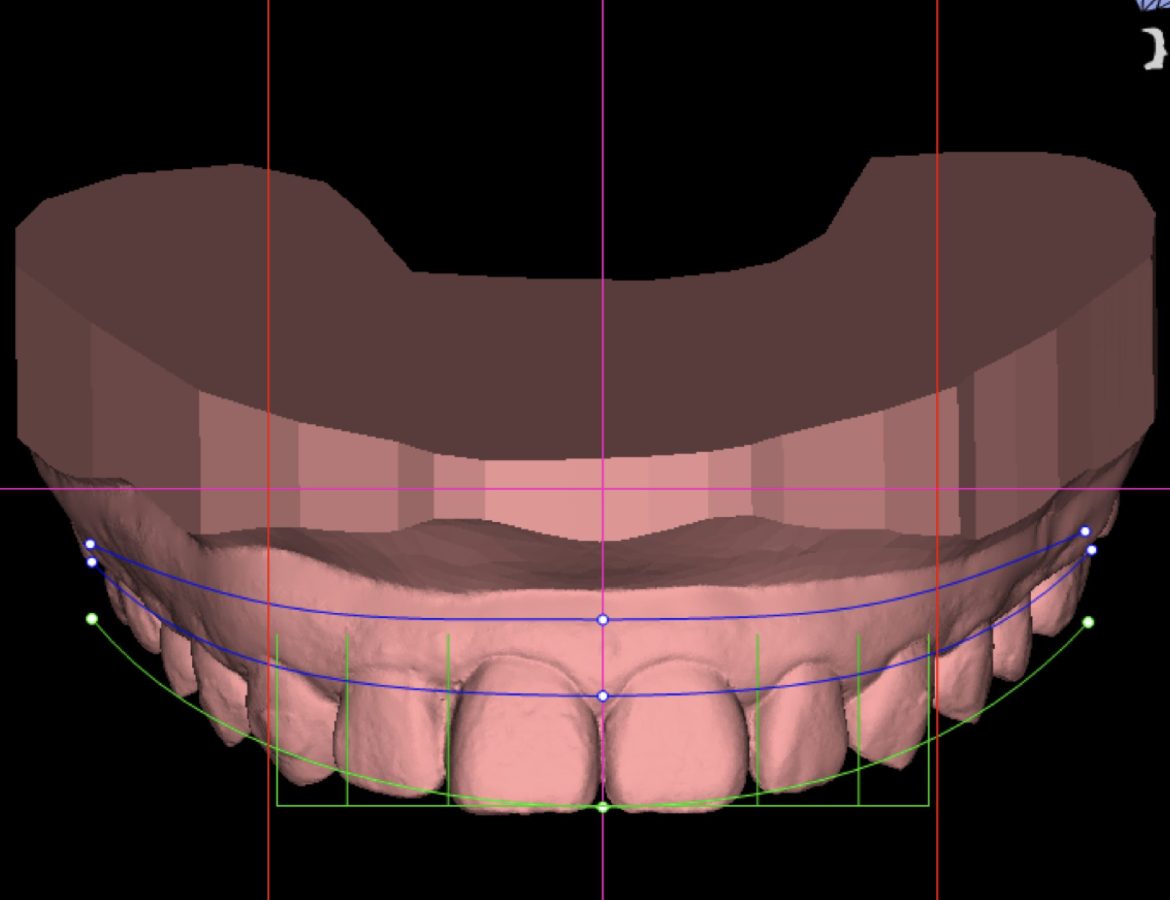 Digital Smile Design (DSD) and Treatment Proposal