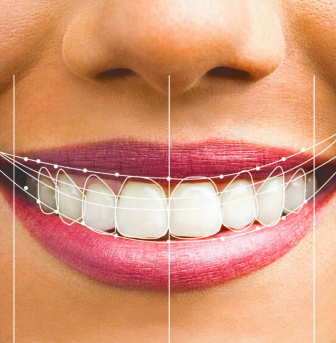 Digital Smile Design