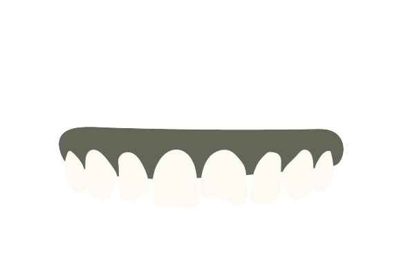 Chipped Teeth