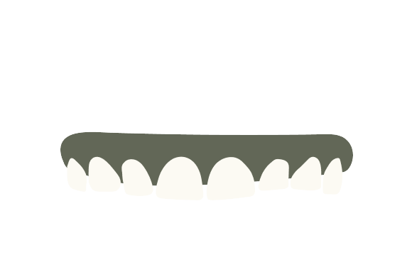 Worn Down Teeth